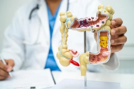 Rola maślanu sodu w zdrowiu jelit: jak ten krótkołańcuchowy kwas tłuszczowy odżywia mikrobiom